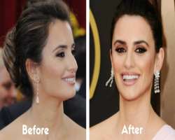 Penelope Cruz before surgery